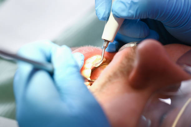 Best Pediatric Emergency Dentist in Hunters Creek, FL